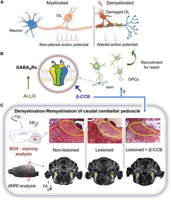 Therapeutic Potential of GABAergic Signaling in Myelin Plasticity and Repair